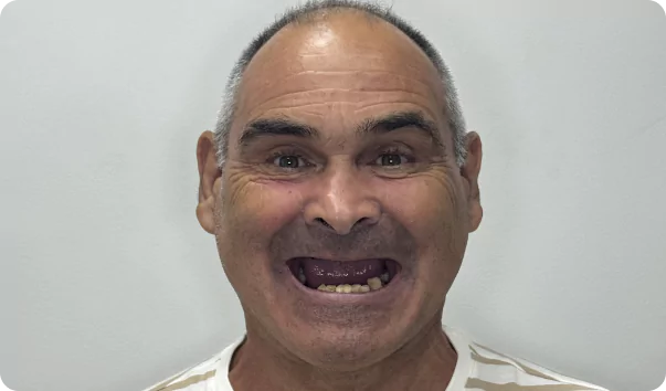 frame-15-68b594e7a750a