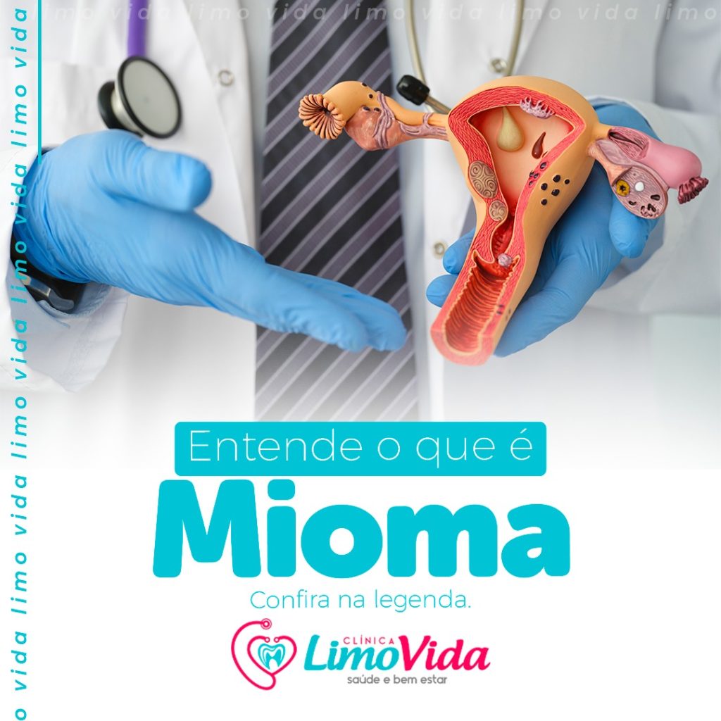 01 GINECOLOGIA 08.2022