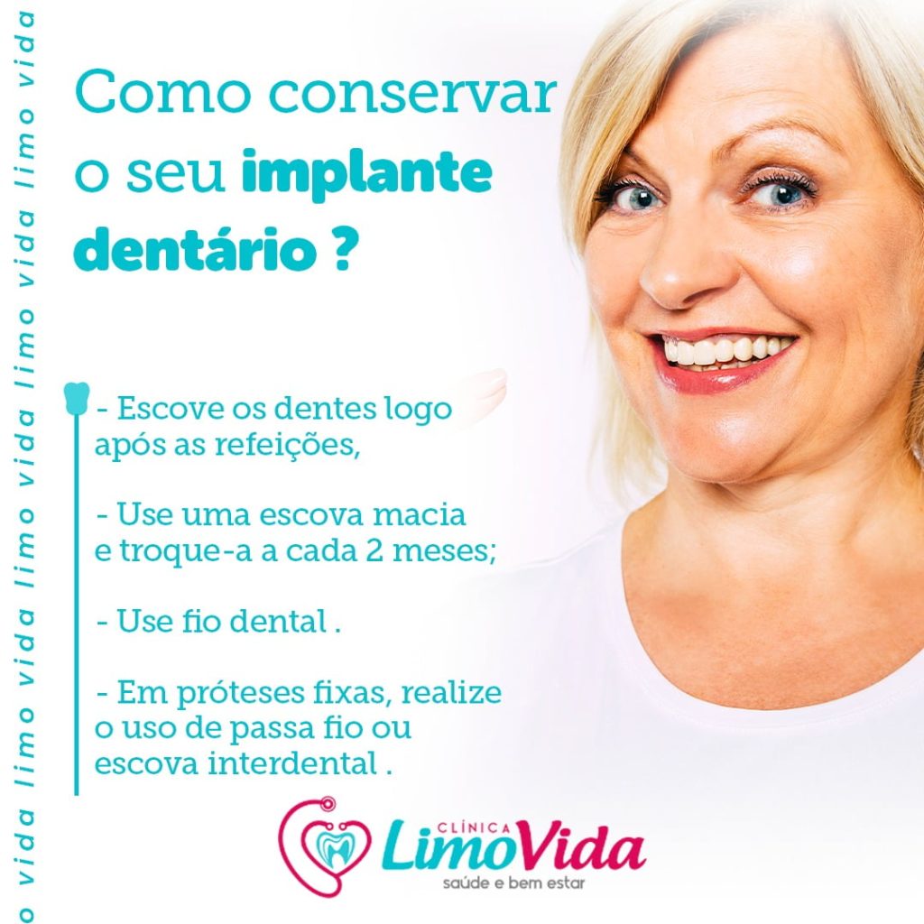 01 IMPLANTE DENTARIO 11.2021