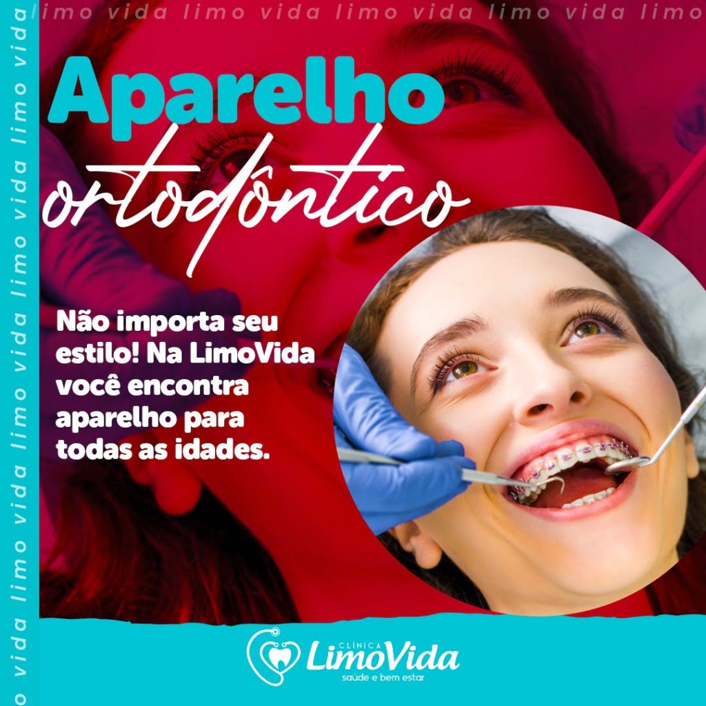 APARELHO ORTODONTICO 11.2021