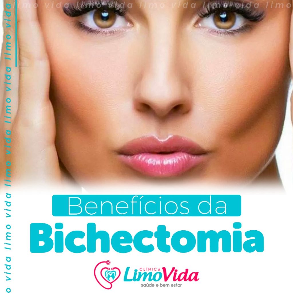 BICHECTOMIA 07.2022