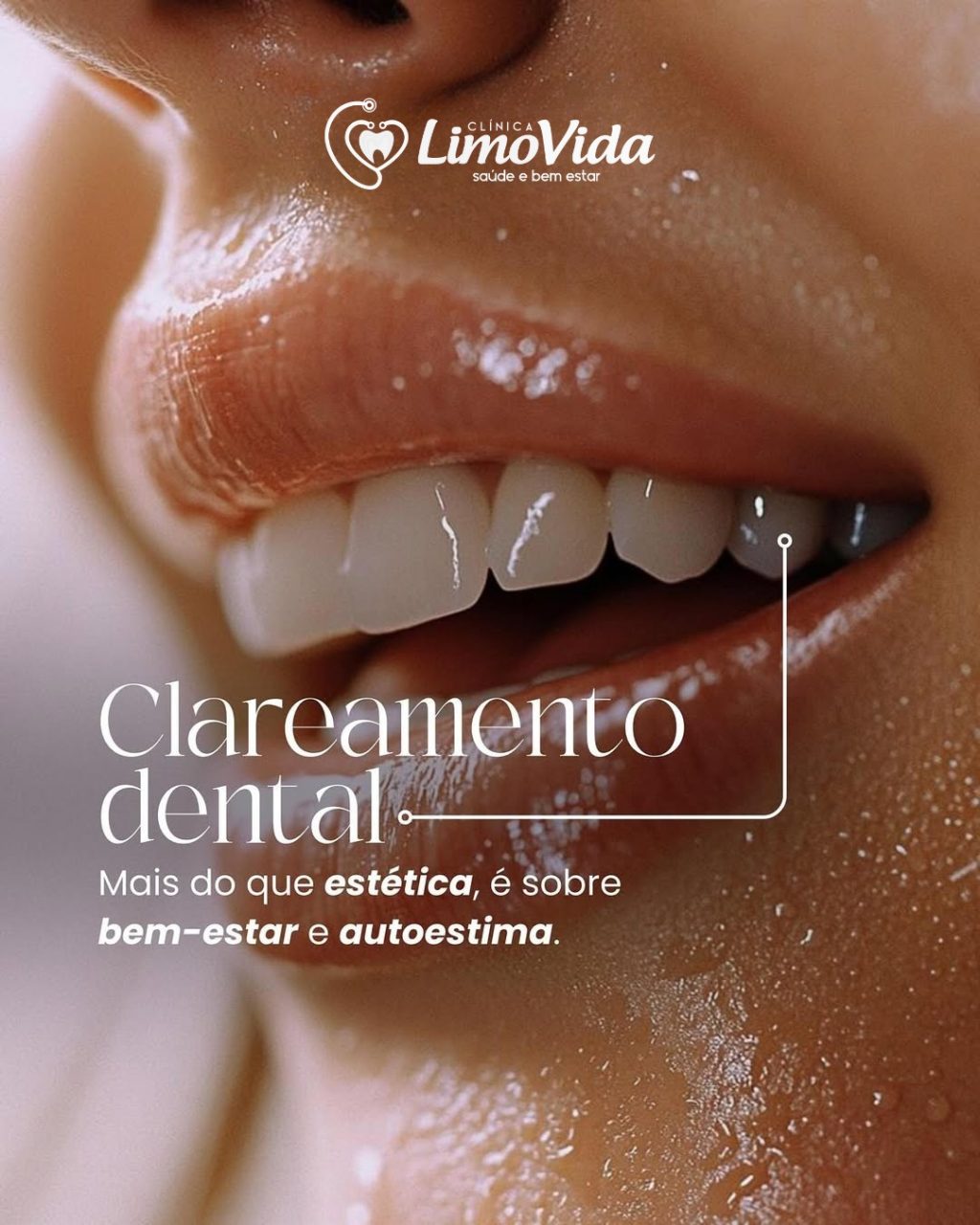 CLAREAMENTO DENTAL BLOG 08.2025