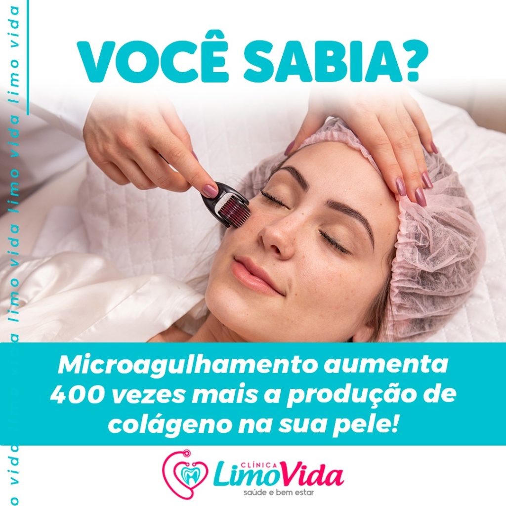 MICROAGULHAMENTO 07.2023 MICROAGULHAMENTO 07.2023