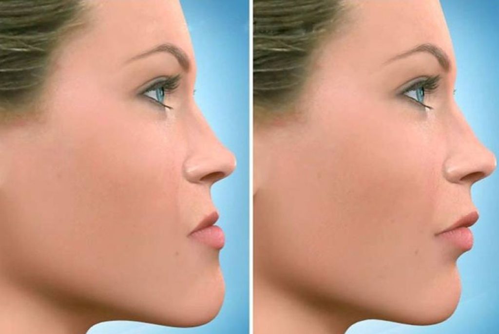 WhatsApp Image 2022-04-19 at 11.21.50